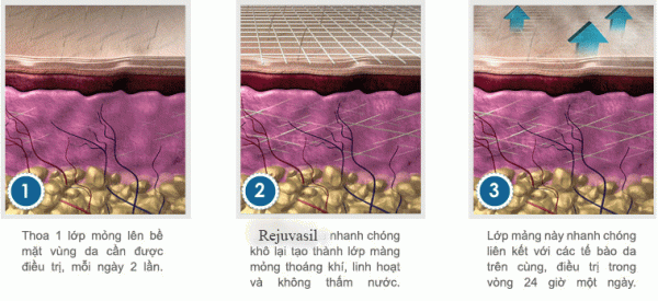 kem-tri-seo-kelo-cote-lam-lien-seo-nhanh-3